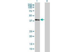 anti-POU Domain, Class 3, Transcription Factor 4 (POU3F4) (AA 1-361) antibody