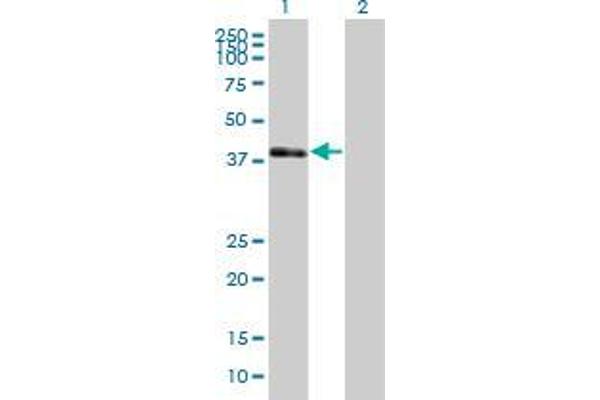 anti-POU Domain, Class 3, Transcription Factor 4 (POU3F4) (AA 1-361) antibody