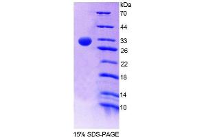 Image no. 1 for Runt-Related Transcription Factor 1 (RUNX1) (AA 1-232) protein (T7 tag,His tag) (ABIN6239503)