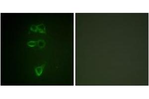Immunofluorescence analysis of HepG2 cells, using TIE2 (Phospho-Tyr1108) Antibody.