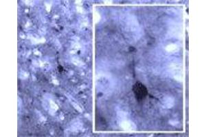 Image no. 3 for anti-Ras-related Protein Ral-A (rala) (AA 150-200) antibody (ABIN350787)