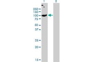 anti-Solute Carrier Family 26 (Sulfate Transporter), Member 2 (SLC26A2) (AA 1-108) antibody