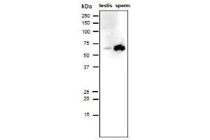 Image no. 3 for anti-Izumo Sperm-Egg Fusion 1 (IZUMO1) antibody (ABIN2452040)