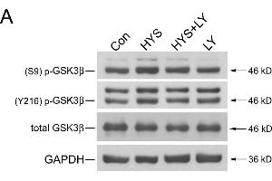 Image no. 75 for anti-Glyceraldehyde-3-Phosphate Dehydrogenase (GAPDH) (Center) antibody (ABIN2857072)