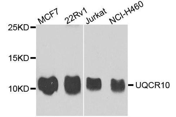 anti-Ubiquinol-Cytochrome C Reductase, Complex III Subunit X (UQCR10) antibody