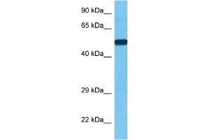 Image no. 4 for anti-phosphoenolpyruvate Carboxykinase 1 (Soluble) (PCK1) (Middle Region) antibody (ABIN2777603)