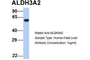 Image no. 4 for anti-Aldehyde Dehydrogenase 3 Family, Member A2 (ALDH3A2) (Middle Region) antibody (ABIN2781792)