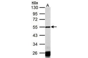 Image no. 2 for anti-Calsequestrin 1 (CASQ1) (AA 136-381) antibody (ABIN1501918)