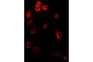Image no. 1 for anti-Stomatin (STOM) antibody (ABIN2967073)