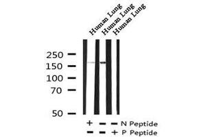 Image no. 3 for anti-Cystic Fibrosis Transmembrane Conductance Regulator (ATP-Binding Cassette Sub-Family C, Member 7) (CFTR) (pThr1471) antibody (ABIN6269851)