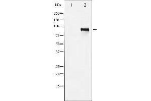 Image no. 4 for anti-Insulin-Like Growth Factor 1 Receptor (IGF1R) (pTyr1161) antibody (ABIN6256620)