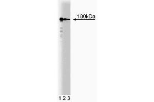 Western Blotting (WB) image for anti-Clathrin (AA 4-171) antibody (ABIN968006)