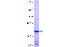 Image no. 1 for Chromosome 10 Open Reading Frame 2 (C10ORF2) (AA 591-684) protein (GST tag) (ABIN1347017)
