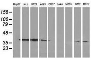 Image no. 5 for anti-Annexin A3 (ANXA3) antibody (ABIN1496642)