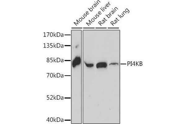 PI4KB Antikörper  (AA 560-801)