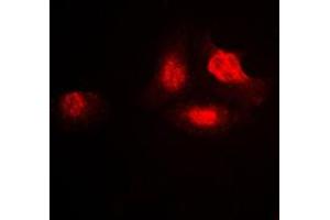 Immunofluorescent analysis of UBA2 staining in A549 cells.