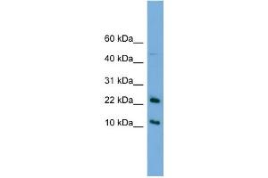 Image no. 1 for anti-GM2 Ganglioside Activator (GM2A) (N-Term) antibody (ABIN2782426)