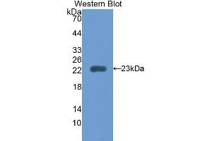 Image no. 1 for anti-Retinol Binding Protein 5, Cellular (RBP5) (AA 19-201) antibody (ABIN1860414)