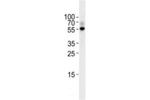 Image no. 3 for anti-Transforming Growth Factor, beta 2 (TGFB2) (AA 277-306) antibody (ABIN3029220)
