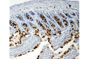 Image no. 5 for anti-Retinoblastoma-Like 1 (p107) (RBL1) (C-Term) antibody (ABIN3032468)