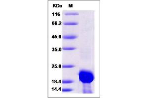 Image no. 1 for Calmodulin 2 (phosphorylase Kinase, Delta) (Calm2) (AA 1-149), (Mature) protein (His tag) (ABIN2005215)