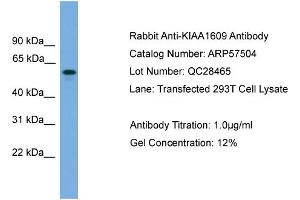 Image no. 2 for anti-MTOR associated protein, eak-7 homolog (MEAK7) (Middle Region) antibody (ABIN2787249)
