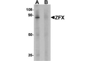 Image no. 2 for anti-Zinc Finger Protein, X-Linked (ZFX) (C-Term) antibody (ABIN1449938)