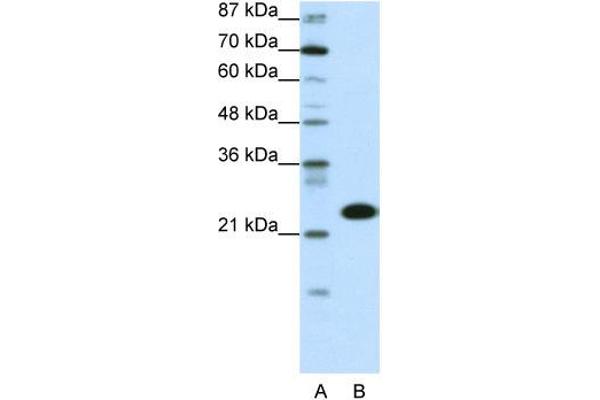 anti-TATA Box Binding Protein Associated Factor 11 (TAF11) (N-Term) antibody
