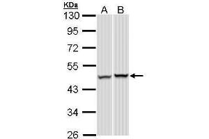 Image no. 5 for anti-Proteasome (Prosome, Macropain) 26S Subunit, ATPase, 5 (PSMC5) (Center) antibody (ABIN2856087)
