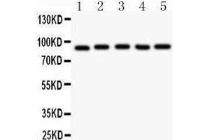 Image no. 2 for anti-Aryl Hydrocarbon Receptor Nuclear Translocator (ARNT) (AA 416-789) antibody (ABIN3043528)