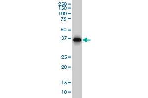 Image no. 2 for anti-Retinitis Pigmentosa 2 (X-Linked Recessive) (RP2) (AA 251-350) antibody (ABIN562683)