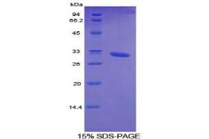 Image no. 1 for Cytochrome P450, Family 26, Subfamily A, Polypeptide 1 (CYP26A1) protein (ABIN3009110)
