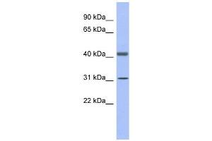 Image no. 1 for anti-Glyceraldehyde-3-Phosphate Dehydrogenase, Spermatogenic (GAPDHS) (N-Term) antibody (ABIN631607)