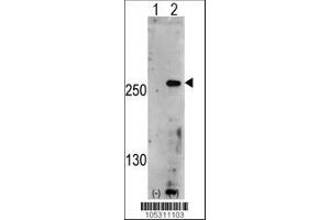 anti-phosphoinositide Kinase, FYVE Finger Containing (PIKFYVE) (AA 1531-1561) antibody