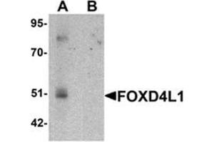 Image no. 1 for anti-Forkhead Box D4-Like 1 (FOXD4L1) (C-Term) antibody (ABIN1450168)