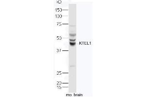 Image no. 1 for anti-Protein O-Glucosyltransferase 1 (POGLUT1) (AA 201-300) antibody (ABIN2559508)