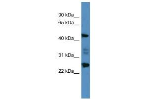 Image no. 1 for anti-Oxidative Stress Induced Growth Inhibitor Family Member 2 (OSGIN2) (C-Term) antibody (ABIN2788325)