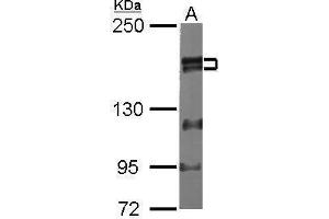 Image no. 2 for anti-Zinc Finger, MYM-Type 2 (ZMYM2) (Center) antibody (ABIN2856121)