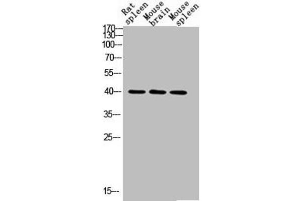 CD72 antibody  (Internal Region)