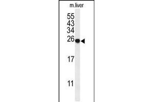 Image no. 2 for anti-Trefoil Factor 2 (TFF2) (AA 231-260), (C-Term) antibody (ABIN5532307)