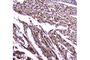Image no. 2 for anti-Nuclear Factor I/B (NFIB) antibody (ABIN5708262)