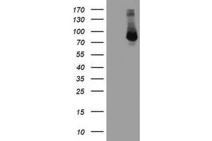 Image no. 2 for anti-F-Box Protein 21 (FBXO21) antibody (ABIN2720944)