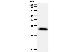Image no. 1 for anti-Ankyrin Repeat Domain 11 (ANKRD11) antibody (ABIN933001)