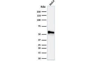 Image no. 1 for anti-Keratin 7 (KRT7) antibody (ABIN6939877)