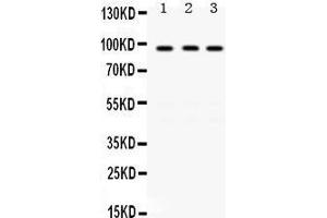 Image no. 1 for anti-K(lysine) Acetyltransferase 2A (KAT2A) (AA 75-106), (N-Term) antibody (ABIN3042472)