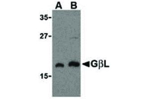 Image no. 1 for anti-G protein beta subunit-like (GBL) (C-Term) antibody (ABIN6656955)
