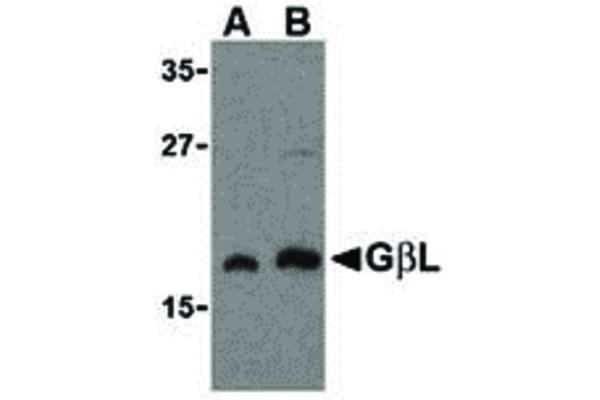 GBL 抗体  (C-Term)
