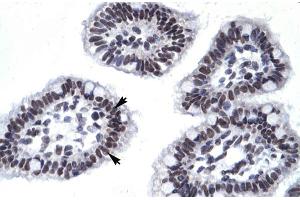 Image no. 1 for anti-Apoptosis Antagonizing Transcription Factor (AATF) (N-Term) antibody (ABIN2777467)