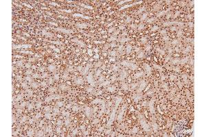 Image no. 3 for anti-Linker For Activation of T Cells (LAT) (pTyr161) antibody (ABIN6271566)