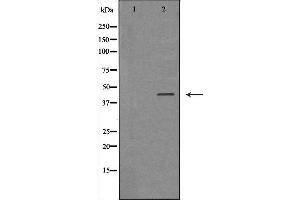 Image no. 1 for anti-Interleukin 2 Receptor, gamma (IL2RG) (N-Term) antibody (ABIN6262563)